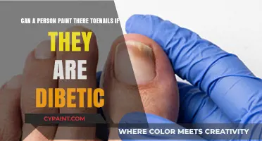 Diabetes and Toenail Care: Can You Safely Paint Your Toenails?