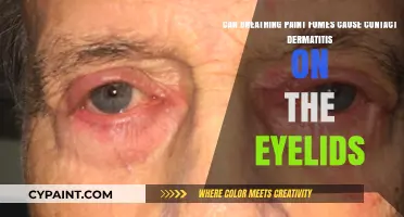 Breathing Paint Fumes: Eyelid Contact Dermatitis Risk Explained