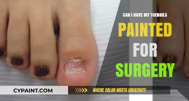 Prepping for Surgery: The Do's and Don'ts of Toenail Polish