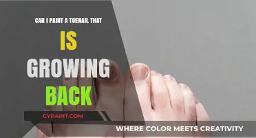 Toenail Trauma: Painting Nails While Growing Back