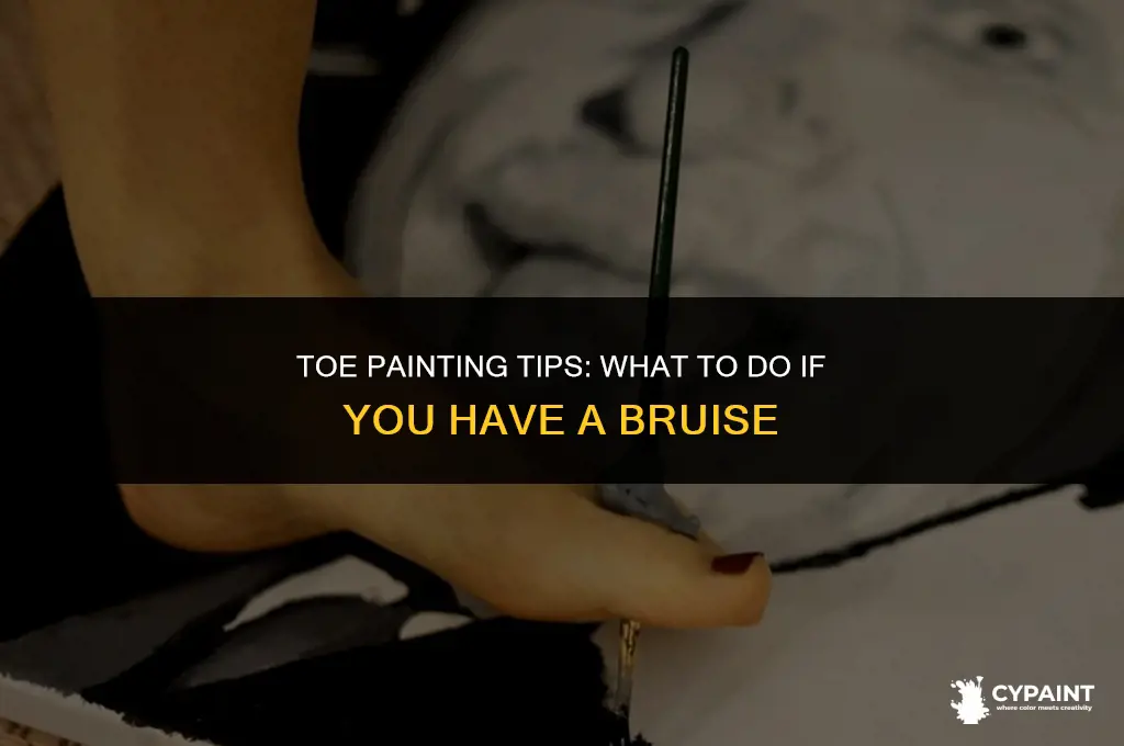 can i paint my toes with a bruise