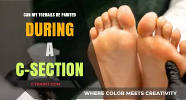 Toenail Painting During C-Section: Is It Possible?