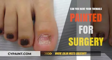 Prepping for Surgery: The Do's and Don'ts of Toenail Polish