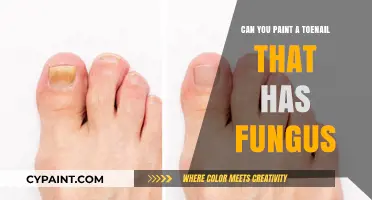 Treating Toenail Fungus: Can You Paint Over It?