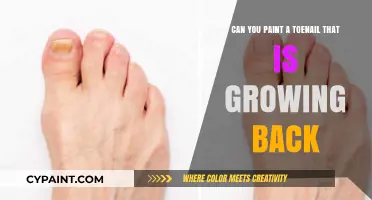 Toenail Trauma: Painting Nails While Growing Back