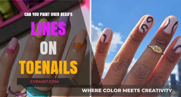 How to Paint Over Beau's Lines on Toenails