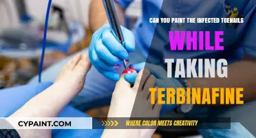Toenail Fungus: Painting Nails While on Terbinafine