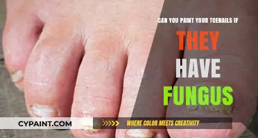 Toenail Fungus: Painting Nails, What's the Deal?