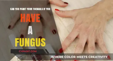 Toenail Fungus and Polish: Safe to Paint or Best to Avoid?