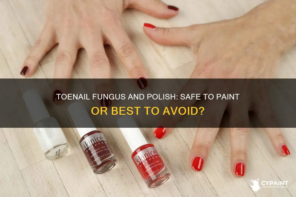 can you paint your toenails if you have a fungus