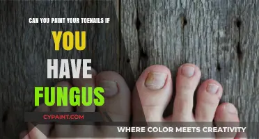 Toenail Fungus: Can You Paint Your Nails?