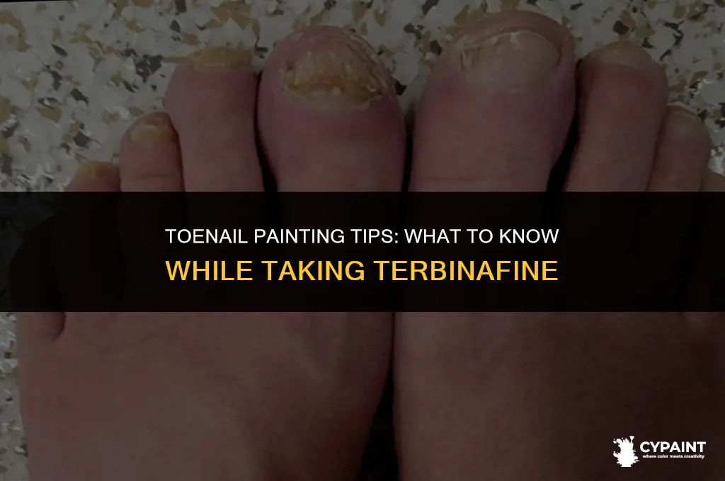 can you paint your toenails while taking terbinafine