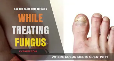 Toenail Fungus Treatment: Can You Paint Your Toenails?