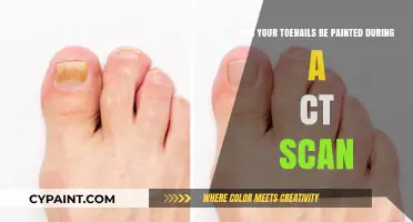 Toenail Paint: Safe for CT Scans?