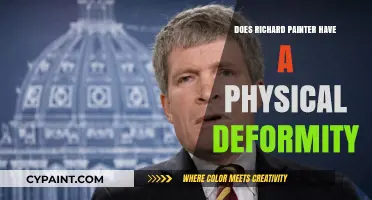 Richard Painter's Physical Appearance: Debunking Deformity Rumors and Facts