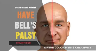 Does Richard Painter Have Bell's Palsy? Facts and Speculations