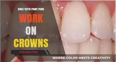 Do Teeth Whitening Pens Effectively Work on Dental Crowns?