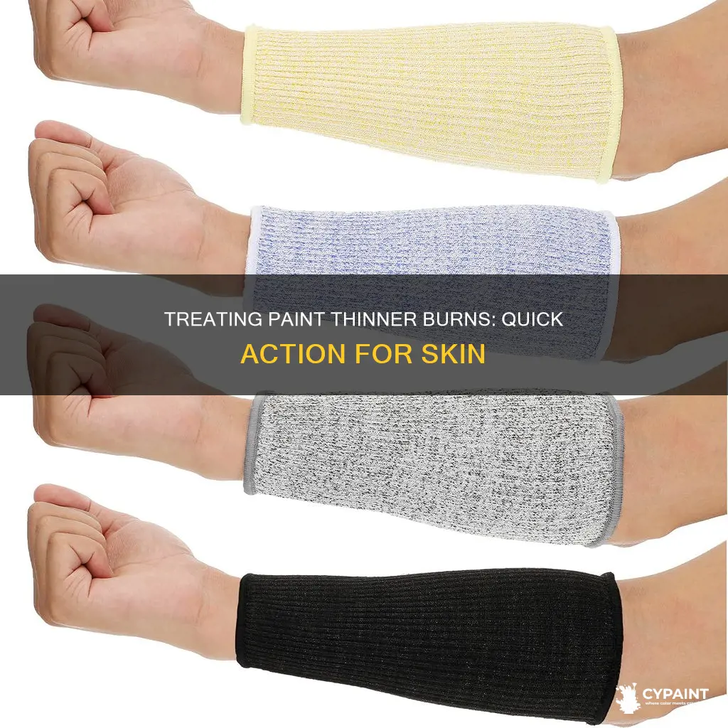 how to neutralize a paint thinner burn on skin