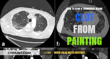 Stop Thumbnail Blood Clots from Painful Painting