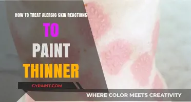 Treating Allergic Skin Reactions to Paint Thinner