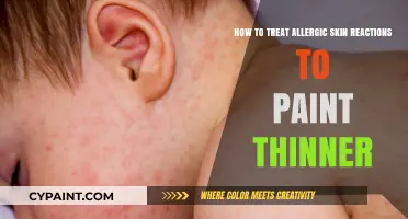 Treating Allergic Skin Reactions to Paint Thinner