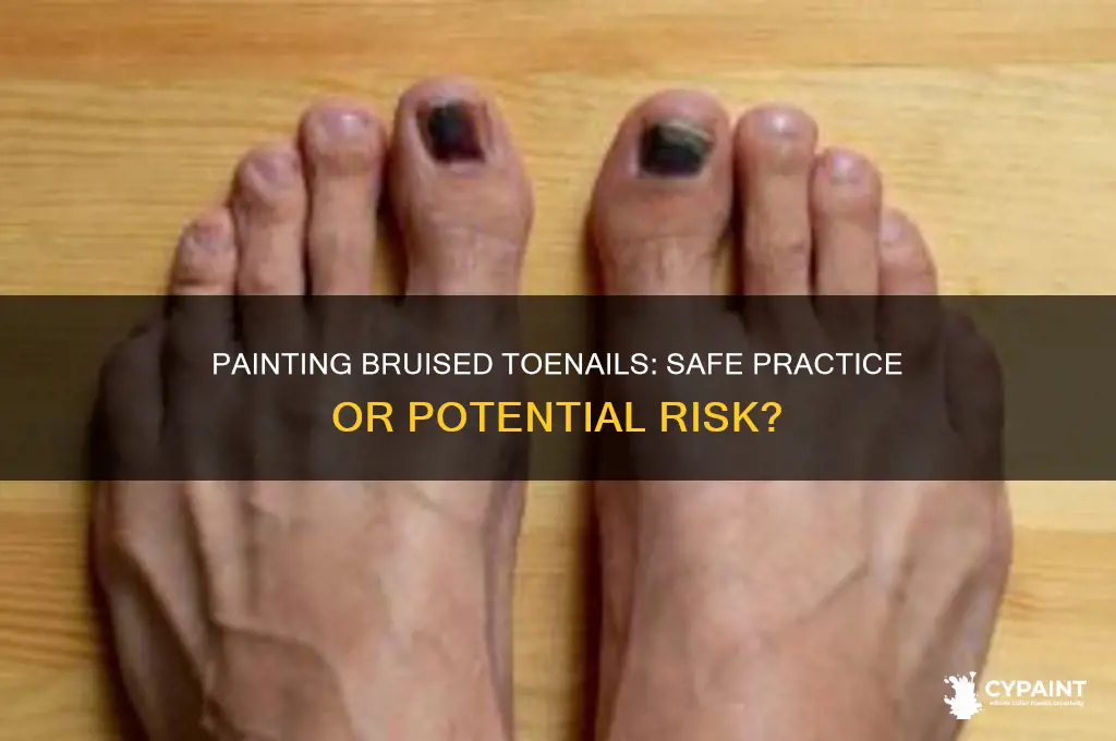 is it ok to paint a bruised toenail