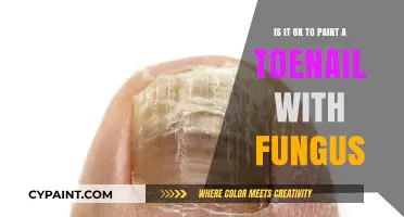 Toenail Fungus: Safe to Paint or Not?