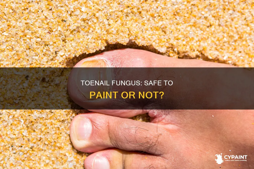 is it ok to paint a toenail with fungus