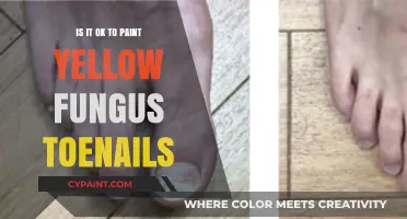 Painting Yellow Fungus Toenails: Safe Practice or Risky Cover-Up?