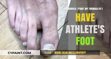 To Paint or Not to Paint: Toenail Care with Athlete's Foot
