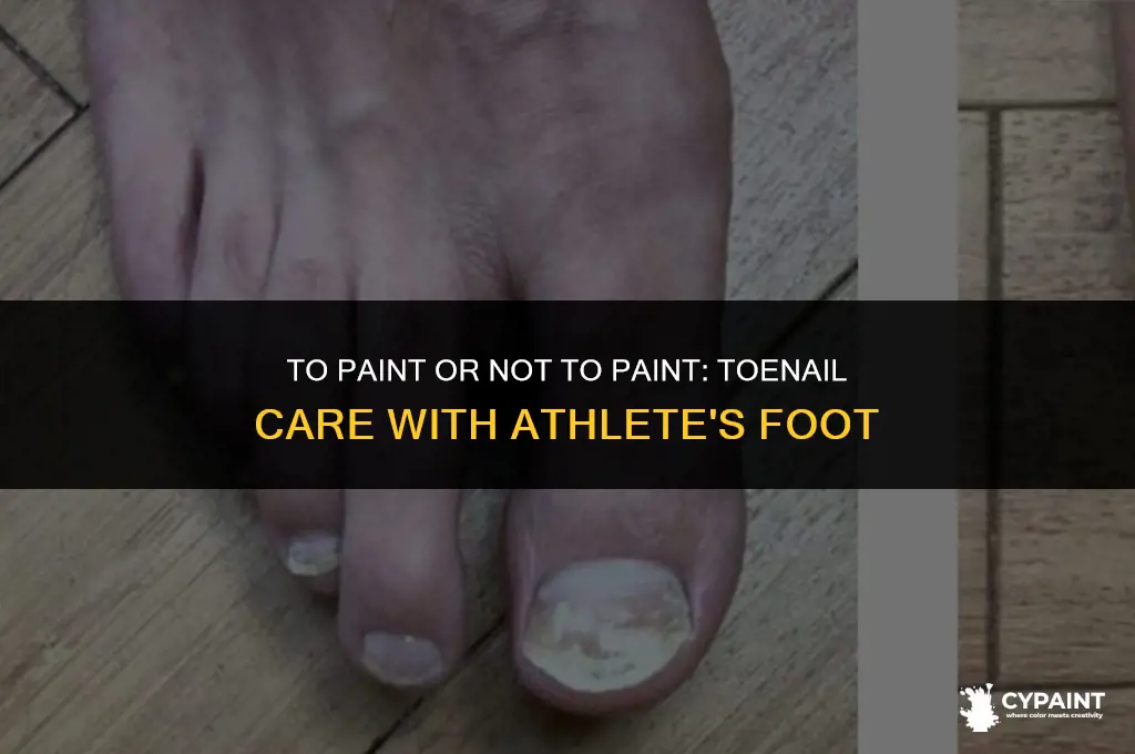 should i paint my toenails if i have athlete