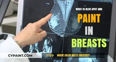 Understanding Blue Spots and Paint-Like Marks on Breasts: Causes and Concerns