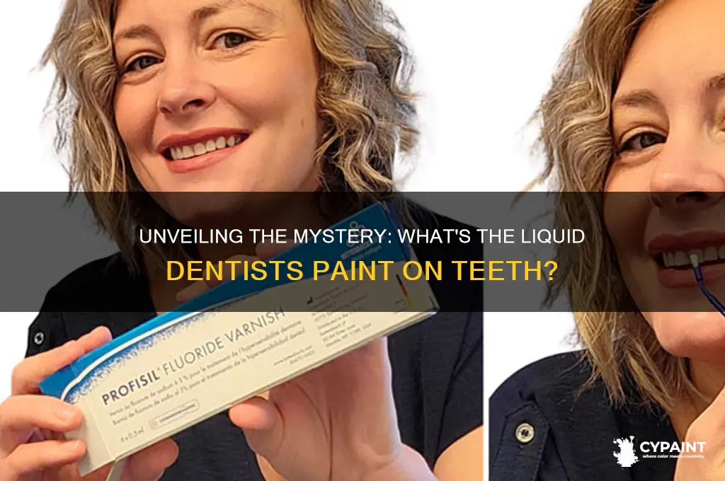 what is that liquid the dentist paints on