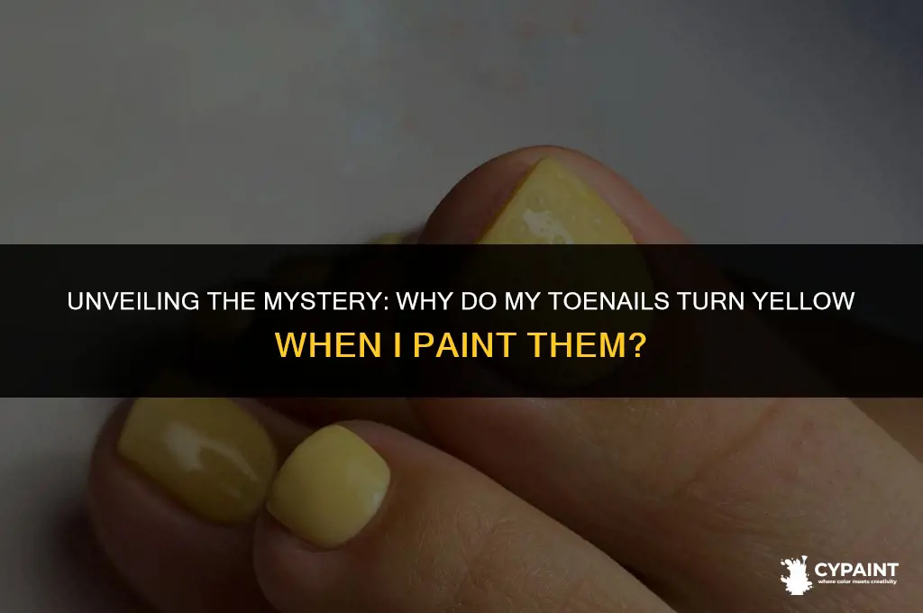 why do my toenails turn yellow when i paint them