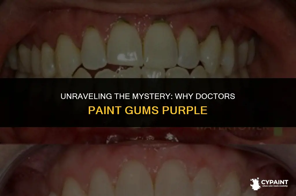 why do the doctors paint everyone