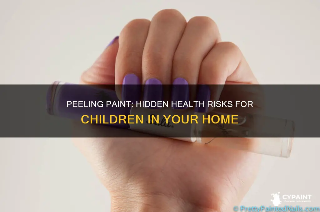 why is peeling paint a health hazard for kids